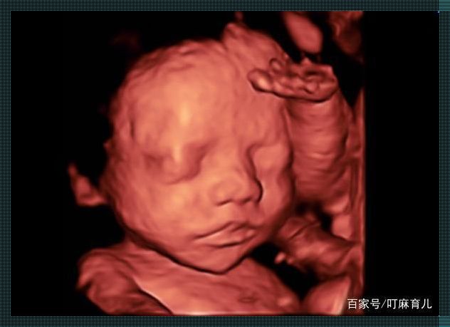 胎儿一直用手挡着脸正常吗？
